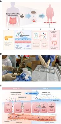 Fecal microbiota transplantation treatment of autoimmune-mediated type 1 diabetes: A systematic review